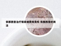 依那西普治疗银屑病费用贵吗 依那西普的用法