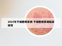 2025年干细胞银屑病 干细胞银屑病临床研究