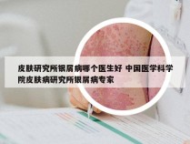 皮肤研究所银屑病哪个医生好 中国医学科学院皮肤病研究所银屑病专家