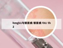 hmgb1与银屑病 银屑病 th1 th2