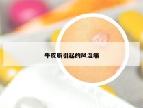牛皮癣引起的风湿痛