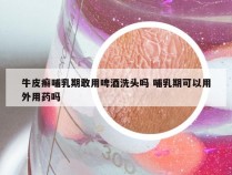 牛皮癣哺乳期敢用啤酒洗头吗 哺乳期可以用外用药吗