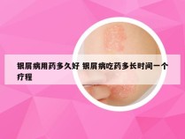 银屑病用药多久好 银屑病吃药多长时间一个疗程
