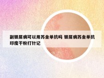 副银屑病可以用苏金单抗吗 银屑病苏金单抗印度干粉打针记