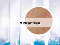 牛皮癣治疗仪加盟