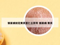 银屑病双花黄芪薏仁土茯苓 银屑病 黄芪