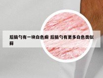 后脑勺有一块白色癣 后脑勺有更多白色类似藓