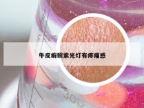 牛皮癣照紫光灯有疼痛感