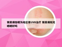 银屑病怕晒为啥还用UVB治疗 银屑病阳光晒晒好吗