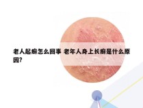 老人起癣怎么回事 老年人身上长癣是什么原因?