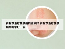 商丘市治疗皮肤病的哪家好 商丘市治疗皮肤病的哪家好一点