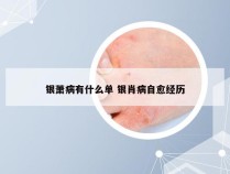 银萧病有什么单 银肖病自愈经历