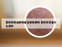 蒽林和焦油制剂能治银屑病吗 蒽林软膏是什么成份