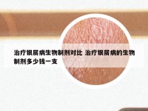 治疗银屑病生物制剂对比 治疗银屑病的生物制剂多少钱一支