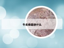 牛皮癣最缺什么