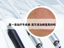 苗一清治疗牛皮癣 苗万清治癣是真的吗
