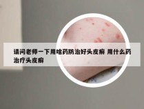 请问老师一下用啥药防治好头皮癣 用什么药治疗头皮癣