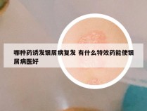哪种药诱发银屑病复发 有什么特效药能使银屑病医好