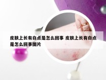 皮肤上长有白点是怎么回事 皮肤上长有白点是怎么回事图片