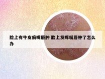 脸上有牛皮癣嘴唇肿 脸上发痒嘴唇肿了怎么办