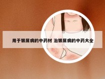 用于银屑病的中药材 治银屑病的中药大全