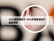 2023银屑病南宁 2021年银屑病治疗最新突破