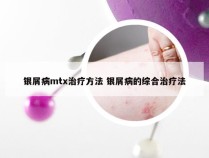 银屑病mtx治疗方法 银屑病的综合治疗法