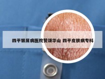 四平银屑病医院赞颂华山 四平皮肤病专科