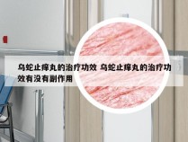 乌蛇止痒丸的治疗功效 乌蛇止痒丸的治疗功效有没有副作用