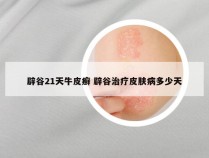 辟谷21天牛皮癣 辟谷治疗皮肤病多少天