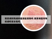 银屑病特殊病种医保能报销吗 银屑病是特殊疾病吗有补助吗