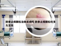 防参止痒颗粒治银屑病吗 防参止痒颗粒吃多久见效
