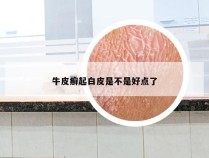 牛皮癣起白皮是不是好点了