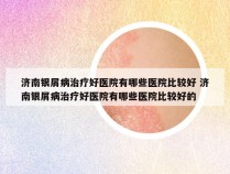 济南银屑病治疗好医院有哪些医院比较好 济南银屑病治疗好医院有哪些医院比较好的