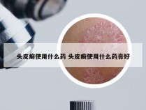 头皮癣使用什么药 头皮癣使用什么药膏好