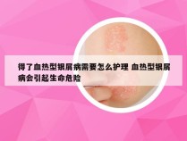 得了血热型银屑病需要怎么护理 血热型银屑病会引起生命危险
