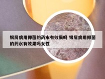 银屑病用抑菌的药水有效果吗 银屑病用抑菌的药水有效果吗女性