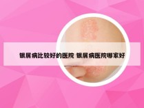 银屑病比较好的医院 银屑病医院哪家好