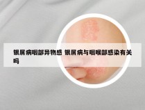 银屑病咽部异物感 银屑病与咽喉部感染有关吗