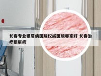 长春专业银屑病医院权威医院哪家好 长春治疗银屑病