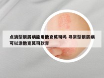 点滴型银屑病能用他克莫司吗 寻常型银屑病可以涂他克莫司软膏