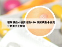 银屑病血小板高计数420 银屑病血小板高计数420正常吗