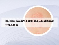 两小腿对应有癣怎么回事 两条小腿对称发痒好多小疙瘩