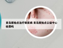青岛原始点治疗银屑病 青岛原始点公益中心收费吗