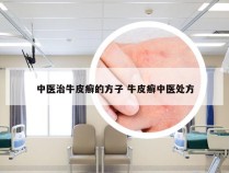 中医治牛皮癣的方子 牛皮癣中医处方