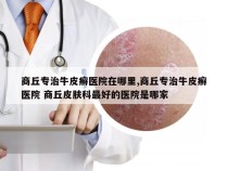 商丘专治牛皮癣医院在哪里,商丘专治牛皮癣医院 商丘皮肤科最好的医院是哪家