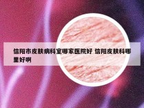 信阳市皮肤病科室哪家医院好 信阳皮肤科哪里好啊