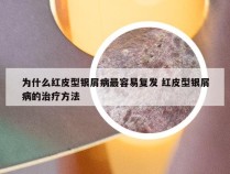为什么红皮型银屑病最容易复发 红皮型银屑病的治疗方法