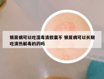 银屑病可以吃湿毒清胶囊不 银屑病可以长期吃清热解毒的药吗