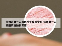 杭州市第一人民医院牛皮癣专科 杭州第一人民医院皮肤科专家